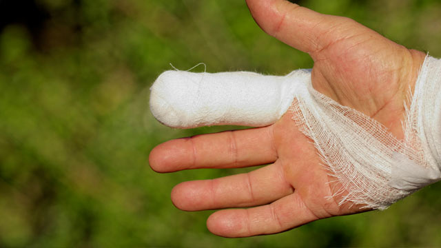 В Тюменской области мужчине в драке откусили палец